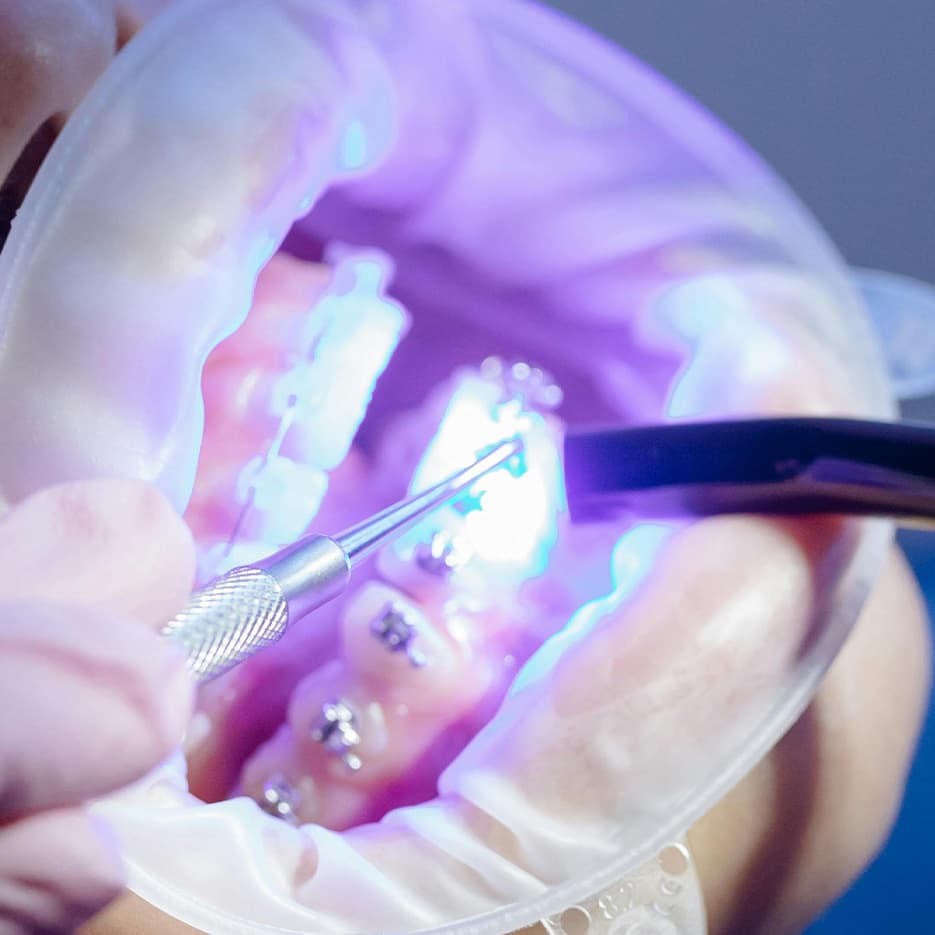 Estetica dentale